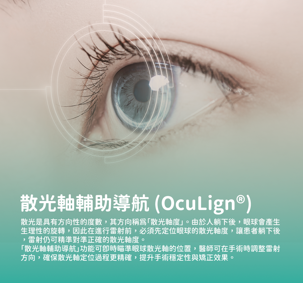 散光軸輔助導航