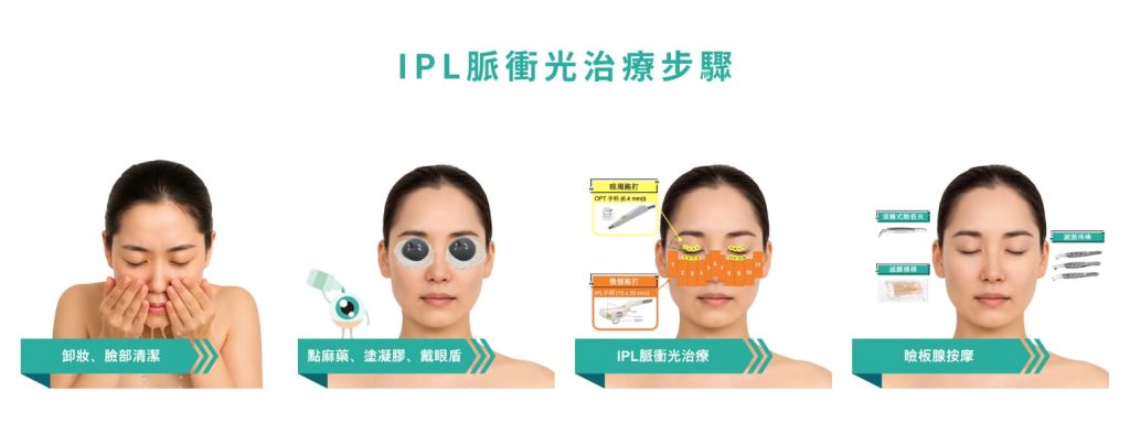 IPL脈衝光治療步驟,信賴眼科,賴麗如醫師