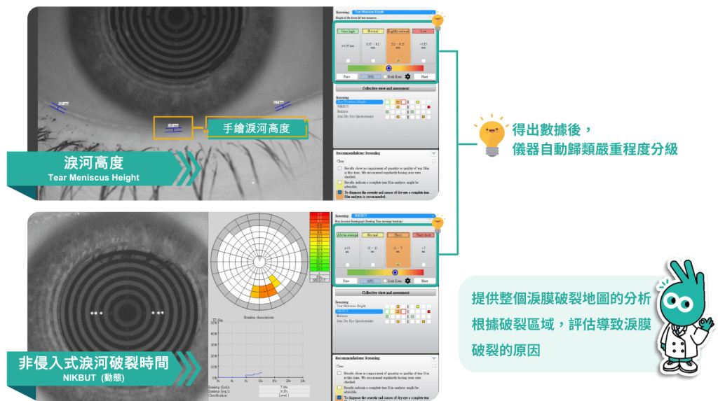 淚河高度,淚河破裂時間,乾眼症,信賴眼科