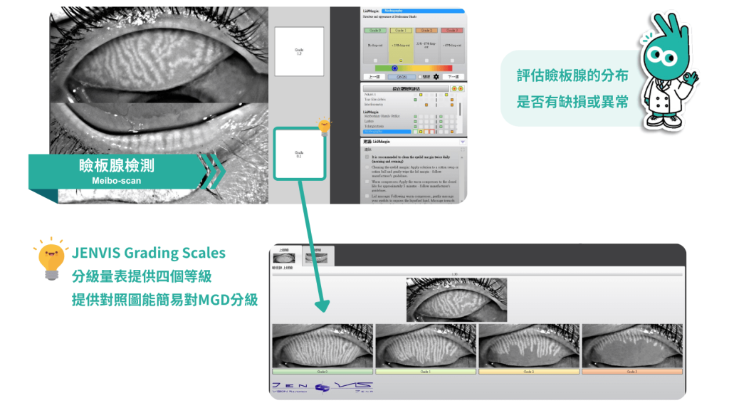 瞼板腺檢測,乾眼症檢查,信賴眼科.賴麗如醫師