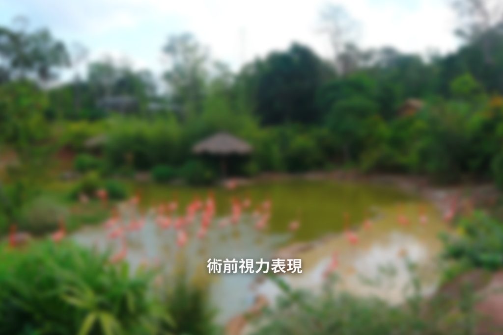 白內障手術,術前視力表現,信賴眼科